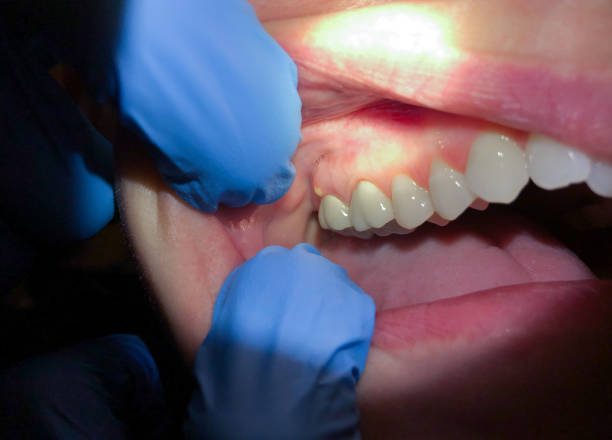 Best Weekend Emergency Dentist in Markesan, WI